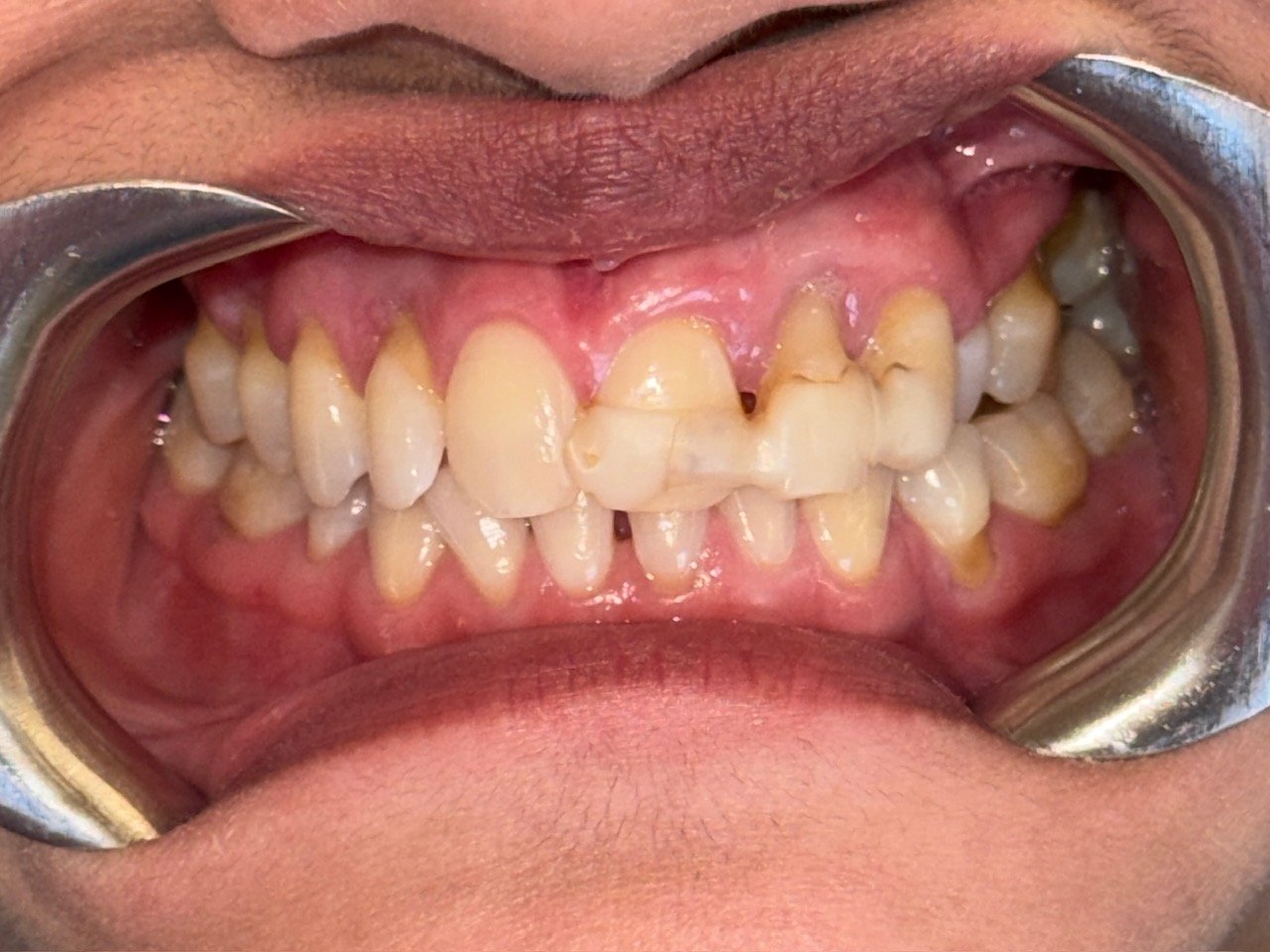 26462259 Susan Abraham 8 Anterior 1